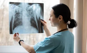 DS2023_TUBERCULOSIS.2e16d0ba.format-webp.fill-1668x1014.webp