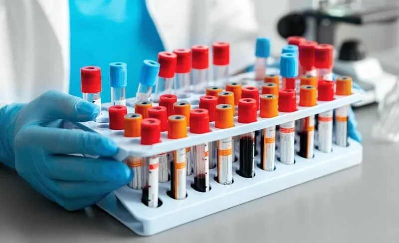 laboratory2.2e16d0ba.format-webp.fill-1668x1014.webp